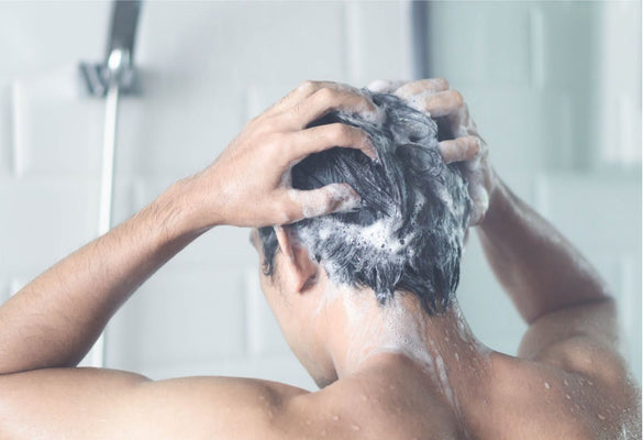 How to Get Rid of Dandruff Fast