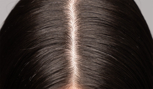 How to Use Anti-Dandruff Shampoo the Right Way