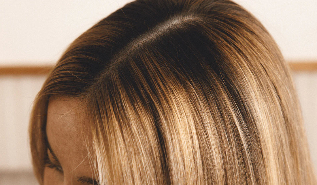 What Causes Severe Dandruff & How to Get Rid of It