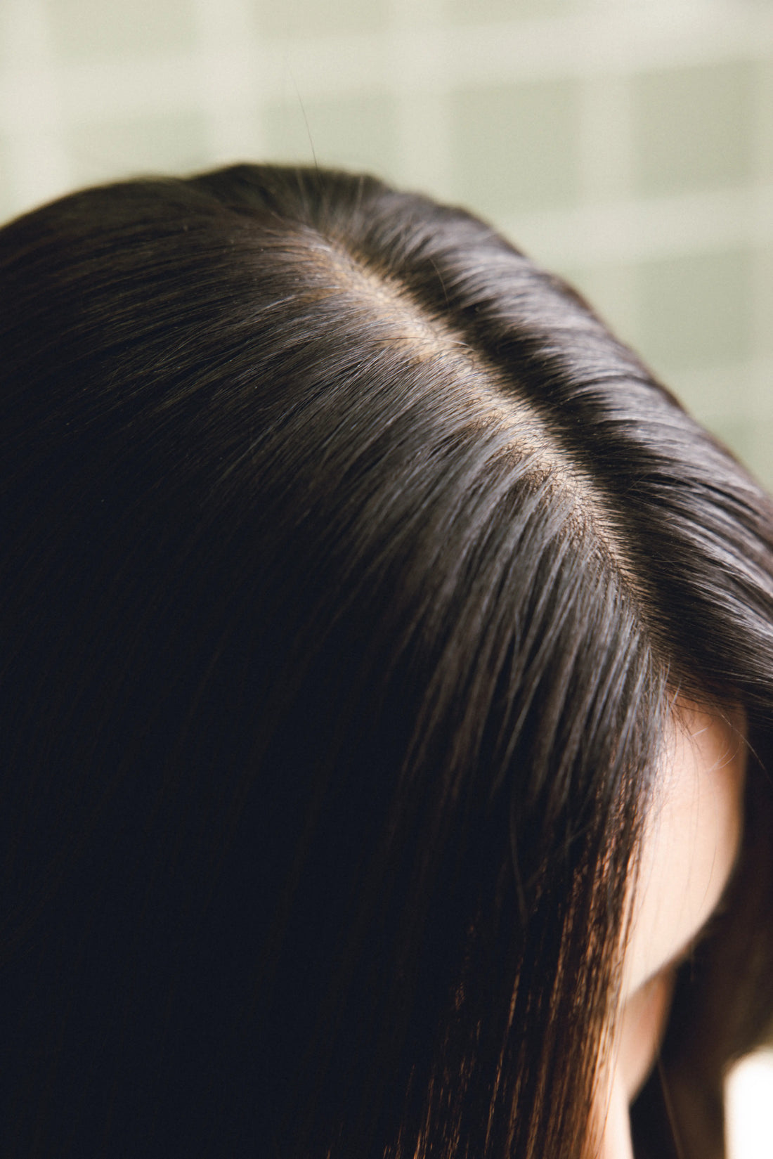 Scalp Psoriasis vs Dandruff: How to Tell the Difference