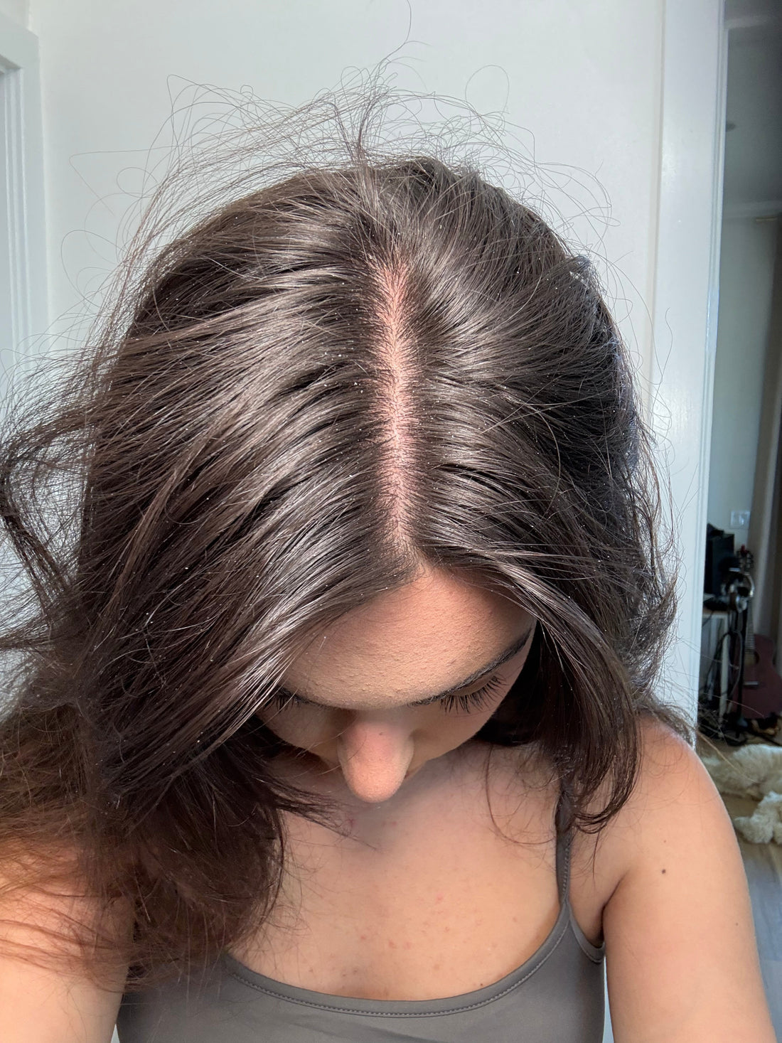 Photo of a woman's hair and scalp that may have dermatitis