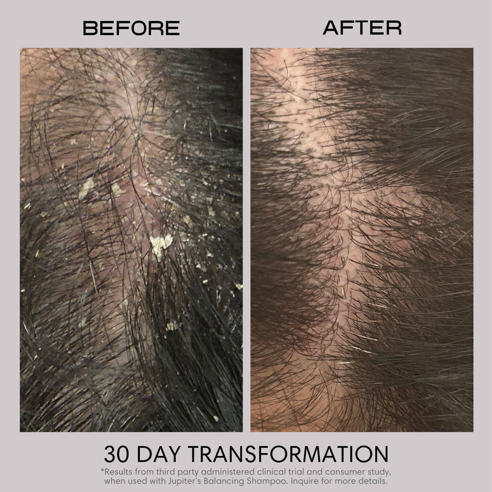 Restoring Serum