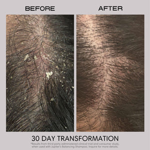 Restoring Serum