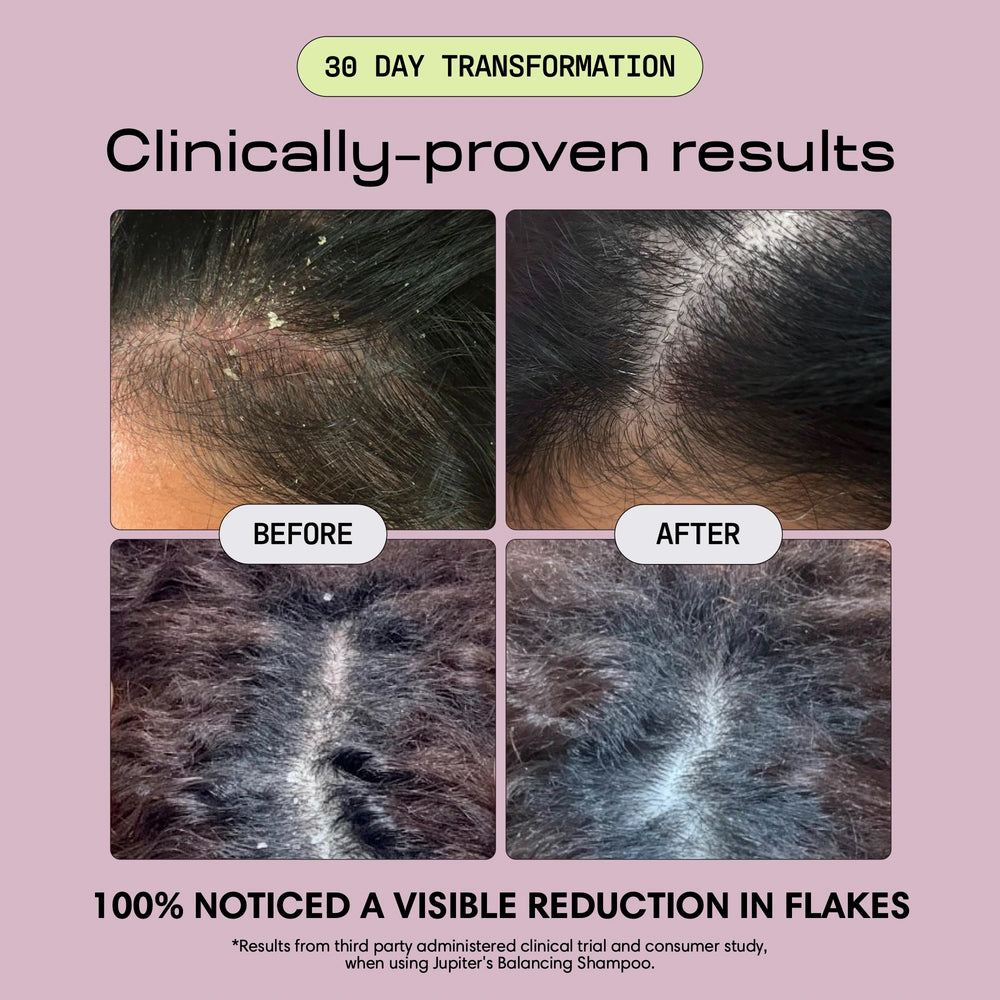 Anti-Dandruff Balancing Shampoo