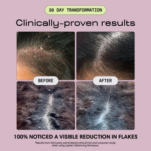 Anti-Dandruff Balancing Shampoo